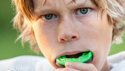 Sports Mouthguards Why Even Amateur Players Should Protect Their Teeth